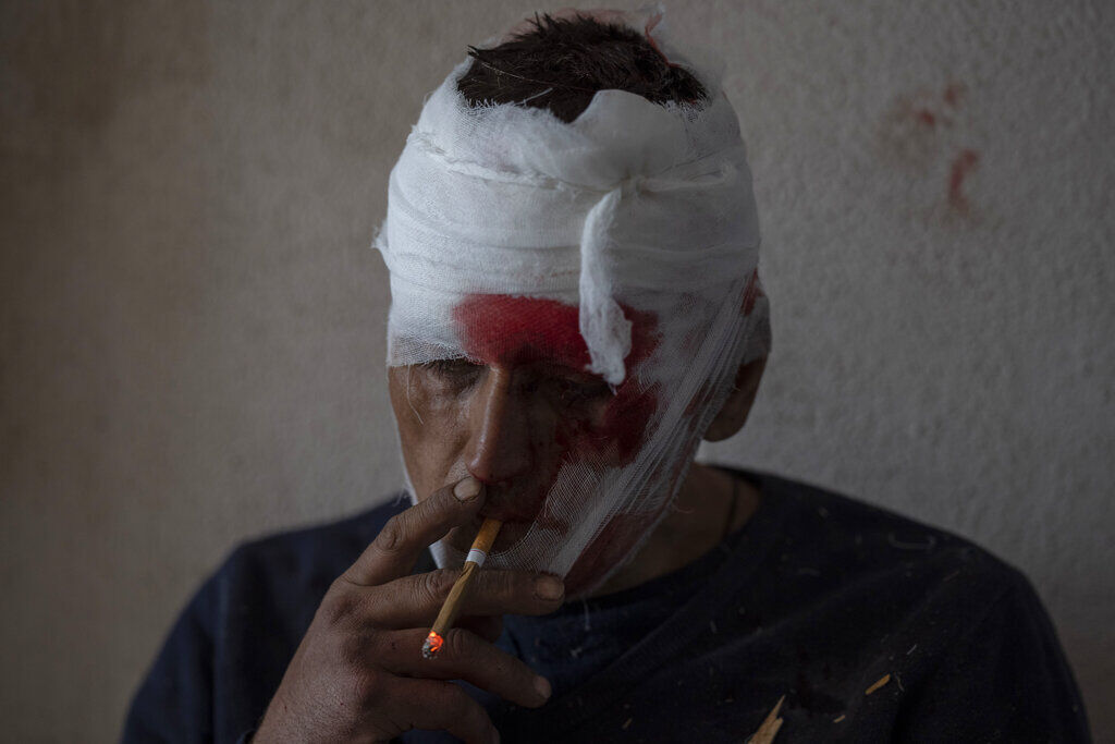 Russia Ukraine War Half A Year Photo Gallery